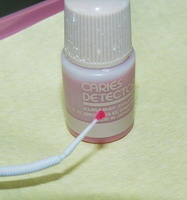 Caries Detector